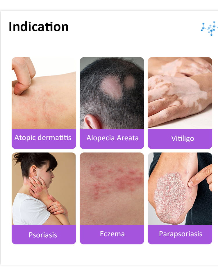 Person using a home UVB phototherapy device as part of a morning routine