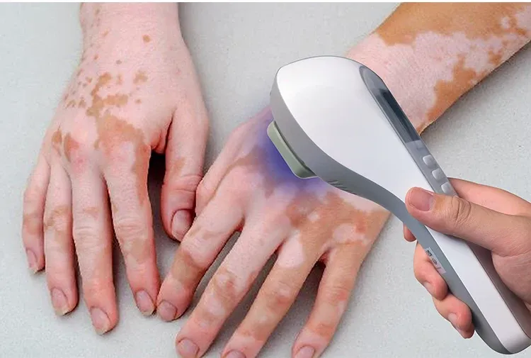 Person using a home UVB phototherapy device as part of a morning routine