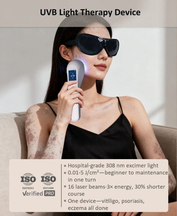 Handheld 308nm UVB light therapy device used for vitiligo treatment