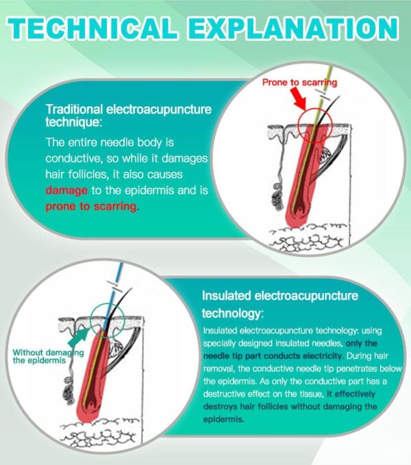 Insulated Electrolysis Pen and Tweezer Set for Precision Epilation